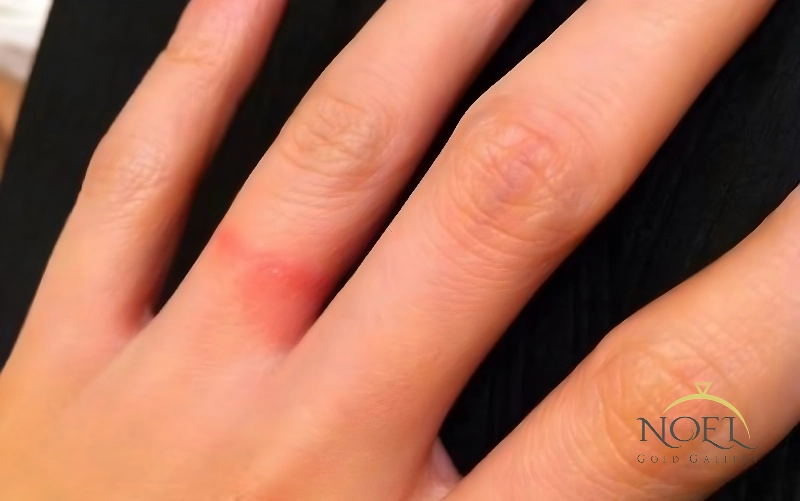 کدام طلا برای پوستهای حساس مناسب است؟ 4 کدام عیار طلا برای پوست حساس بهتر است؟